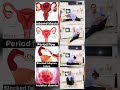 Periods flow, Blocked fallopian tube,  Conceive naturally with yoga#motivation#irregularperiod#yoga