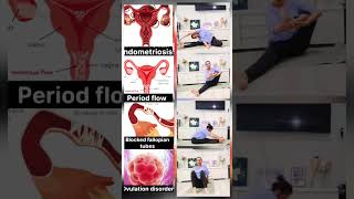 Periods flow, Blocked fallopian tube,  Conceive naturally with yoga#motivation#irregularperiod#yoga