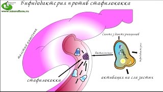 Как лечить кишечник. Проверенный способ вылечить кишечник. Как лечить кишечник. Проверенный способ вылечить кишечник.
