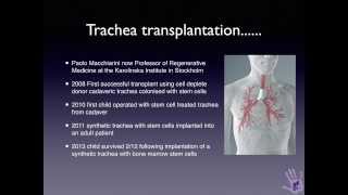 The Stem Cell Story