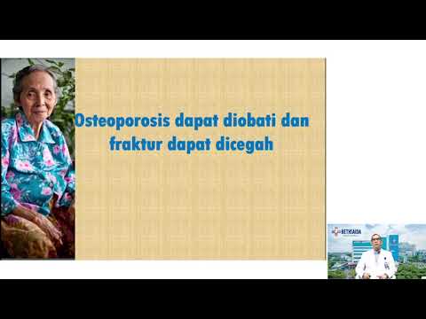 PENYEBAB OSTEOPOROSIS, CARA MENCEGAH DAN METODE PENGOBATANNYA (Webinar)