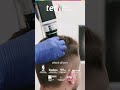 Hair Diagnosis: Clinical Keys for Treating Alopecia ❘ TECH Global University