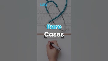 Can AI Replace Medical Coders? The Truth You Need to Hear #llri #medicalcoder