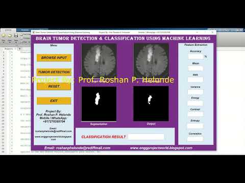 Tumor Identification Using Machine Learning Matlab Project With Source Code Brain Tumor Detection