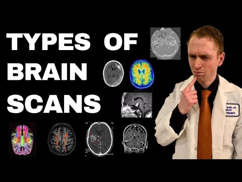 How Many Types Of Scanning Are There