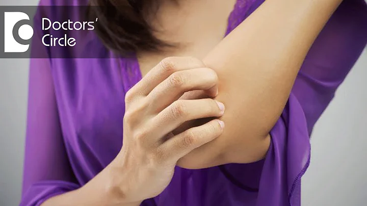 Causes of generalized itching without rash - Dr. Rashmi Ravindra - DayDayNews