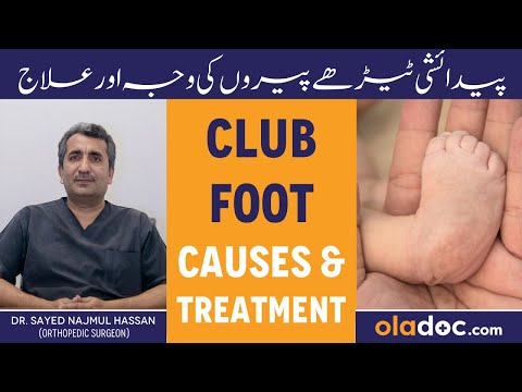 Club Foot Kya Hai - Bacho Ke Paidaishi Teray Paon - Childhood Deformity - Club Foot Kaise Thik Karen thumbnail image