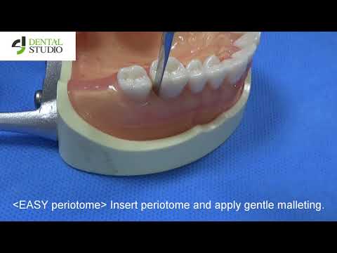 Atraumatic extraction by dental studio