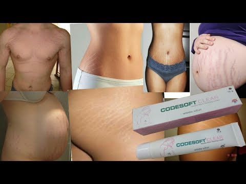 codesoft clear stretch mark cream