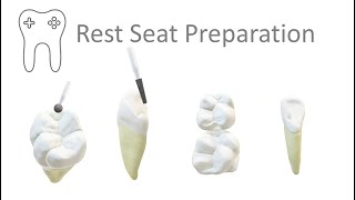 RPD Rest Seat Preparation technique in 6 mins