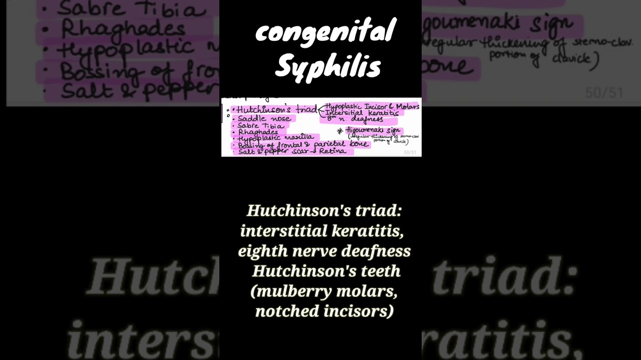 congenital syphilis (Hutchinson triad) YouTube