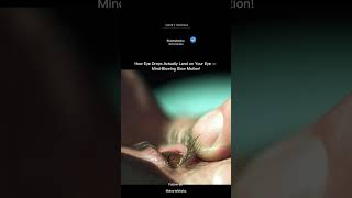What Happens When You Put In Eye Drops? Slow Motion Close-Up!