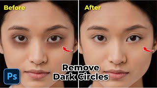 Easy Remove Dark circles under eye in photoshop screenshot 5