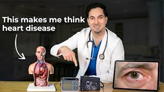 7 Heart Disease Signs & Symptoms You Can Spot Quickly screenshot 3