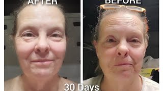 30 Days of Skin Nutrition 11-30-22