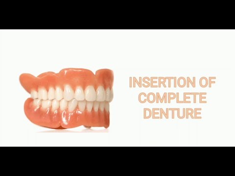 Insertion of Complete Denture - YouTube