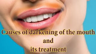 Causes of blackness around the mouth and its treatment