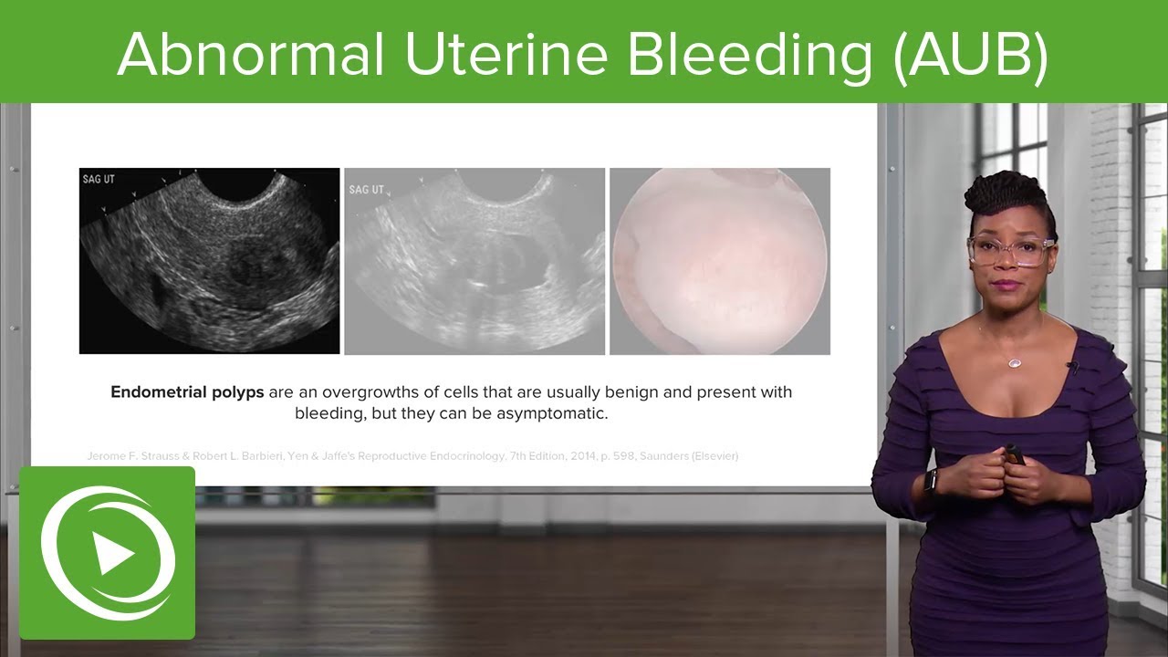 ⁣Abnormal Uterine Bleeding (AUB): Introduction and Classification – Gynecology | Lecturio