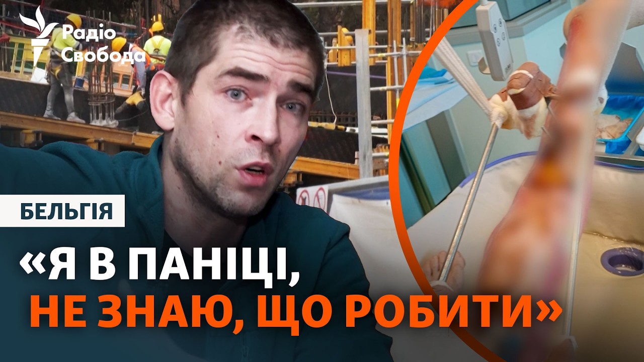 Украинец потерял ногу на заработках в Бельгии, теперь судится с властями страны