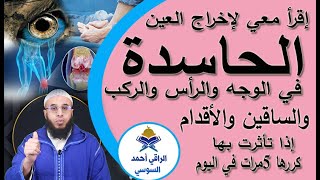 إخراج العين الحاسدة في دقائق في الوجه والرأس والركب والساقين والاقدام ruqyay
