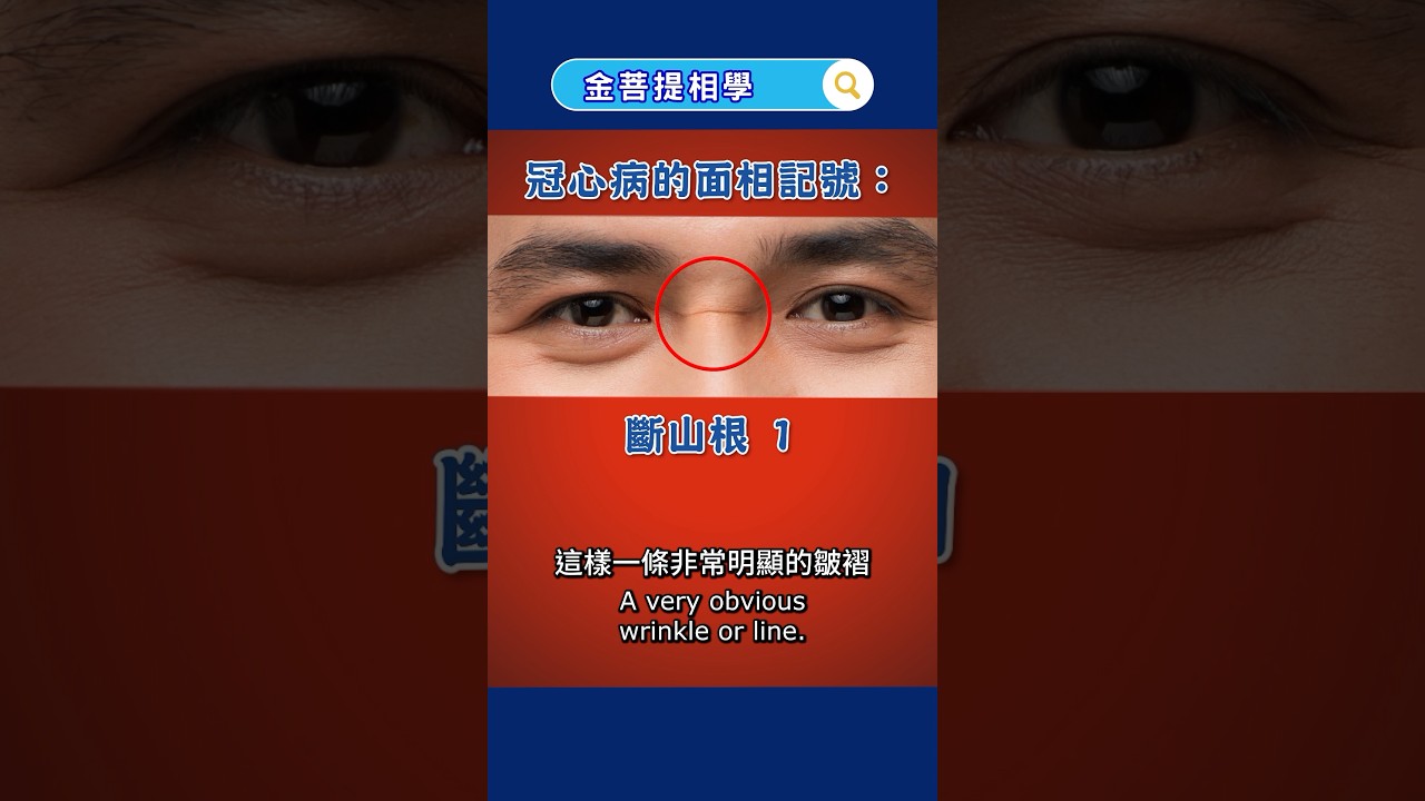 A wrinkle on the nose bridge can be a sign of heart problems? #JinBodhiPhysiognomy # heartdisease