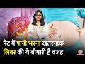 पेट फूला-फूला रहता है? हल्के में न लें! पेट में पानी भरा हो सकता है | Ascites in hindi | Sehat 1395