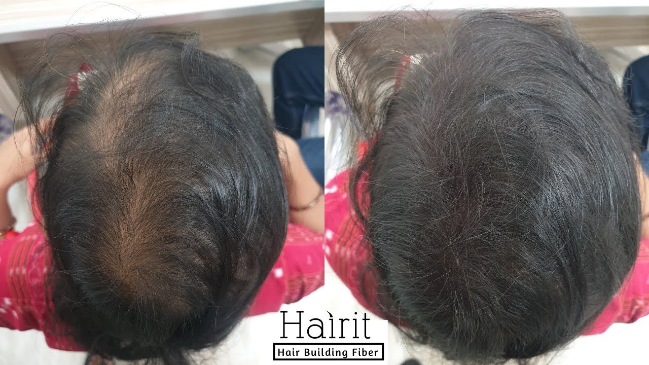 Hair Build Fibers - Hair Loss, Baldness 