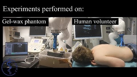 Automatic Normal Positioning of Robotic US Probe based on Confidence Map Optimization and Force