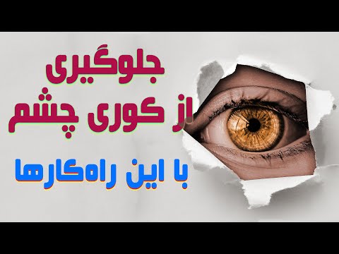 پیشگیری از آب سیاه و مراقبت از چشم و راه کارهایی برای درمان گلوکوم