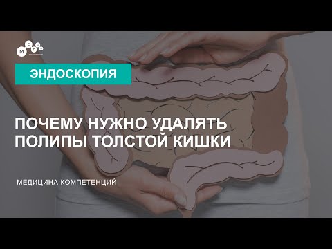 Удаление полипов толстой кишки. Удаление полипов в кишечнике при колоноскопии