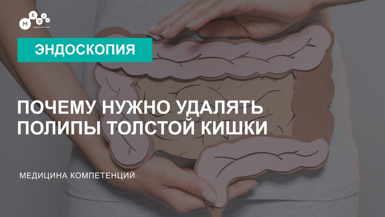 Как питаться после удаления полипа. Удаление полипов в кишечнике. Удалить полип толстой кишки. Полипы при колоноскопии.