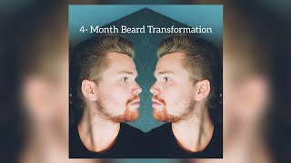 Beard Timelapse  4 Month Patchy Beard Growth