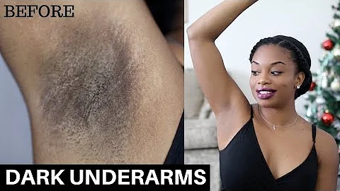 6 Months Update | How To Lighten Dark Underarms Na...