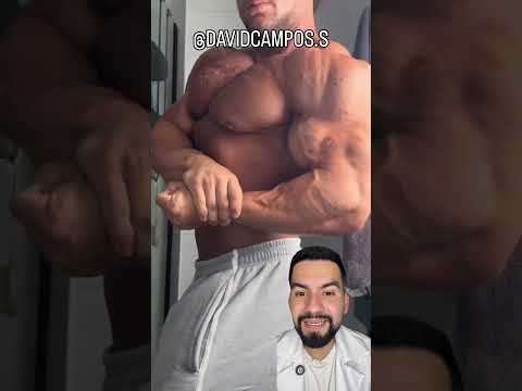 ACNÉ QUELOIDE