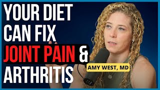 Arthritis, Joint Pain from SUGAR & Junk Food: Harvard Doctor Tells All