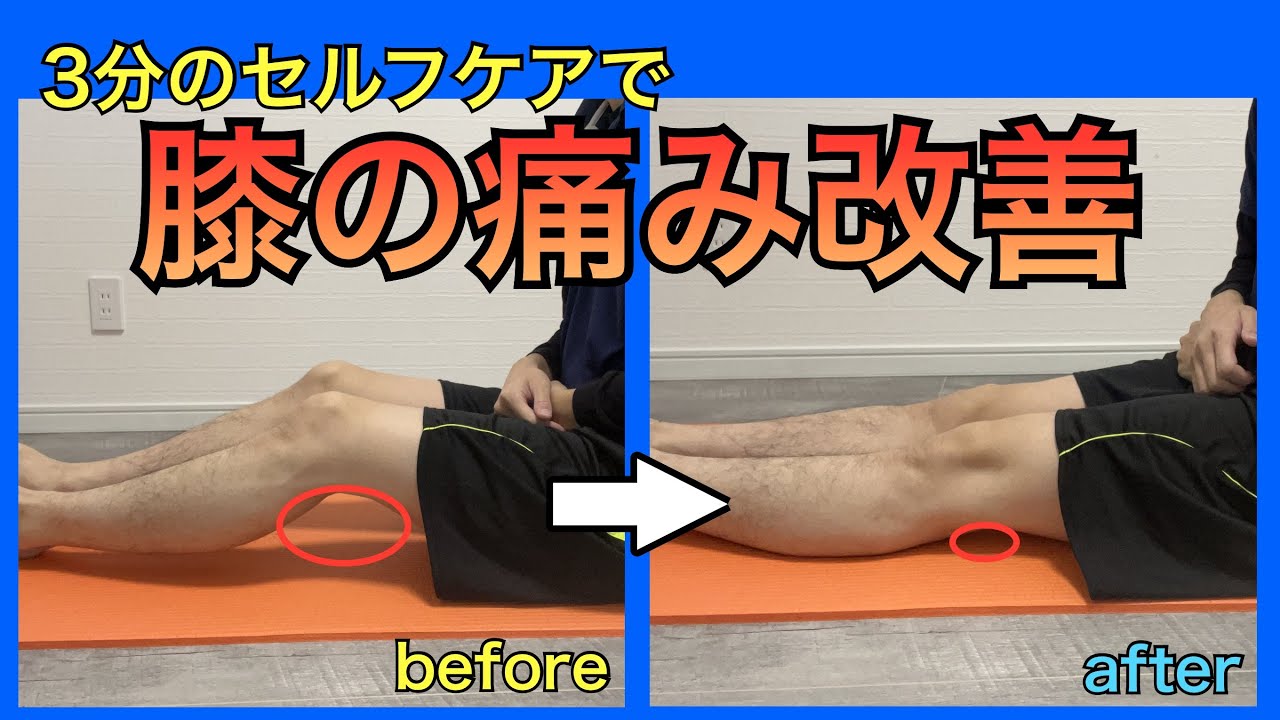 膝の痛み改善法~1日5分から始める、自宅簡単エクササイズ~[DVD]★サポーター・コンドロイチン・グルコサミンで駄目だった方もOK!★ Amazon.co.jp: 膝の痛みの治し方 即効性ある簡単ストレッチ5分だけ 膝