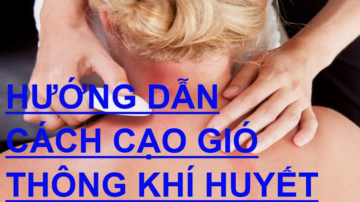 Hướng dẫn cạo gió để đỡ đau đầu