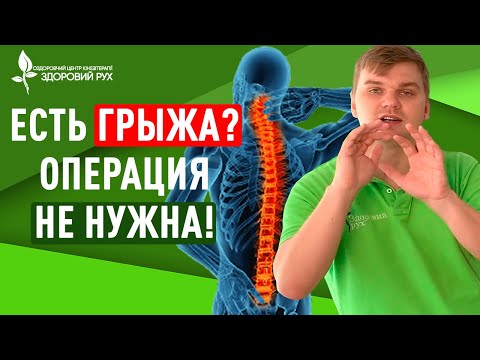 Вопрос: Как проверить, есть ли у вас грыжа?