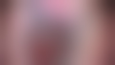 Phaco chop technique  vertical  with the Neuhann Chopper Phakoemulsifikation Cataract Operation