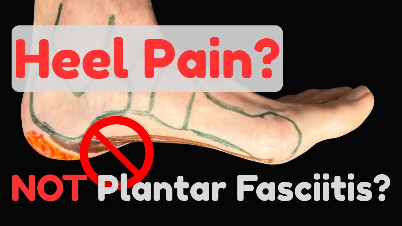 Всё ещё болит пятка? 5 проблем, которые НЕ связаны с подошвенным фасциитом