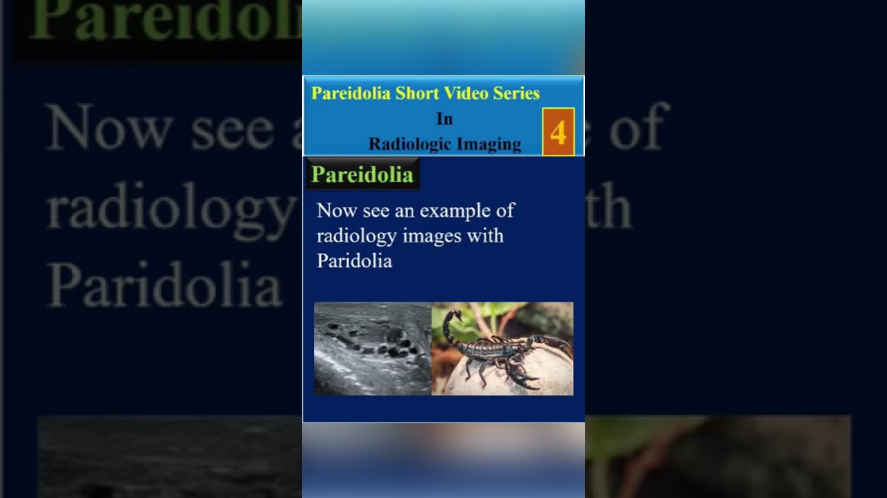 Pareidolia Short Video Series In Radiologic Imaging, Sunrise ( video5)# shorts