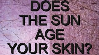 Does The Sun Age Your Skin? 41 Year Study