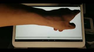How to accept coupons on Clover POS with Cloud Crm 