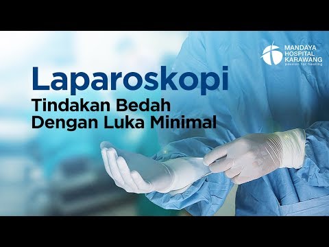 Video: Adhesiolysis Manfaat Bedah Perut, Risiko, Dan Waktu Pemulihan