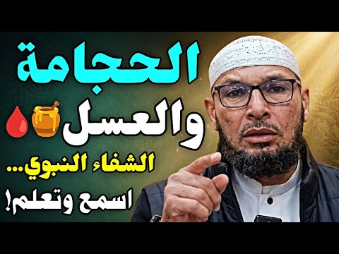 الحجامة والعسل.. الشفاء النبوي اسمع وتعلم 🍯🩸 | درس ممتع لفضيلة الشيخ طاهر ضروي #الشيخ_طاهر_ضروي 
