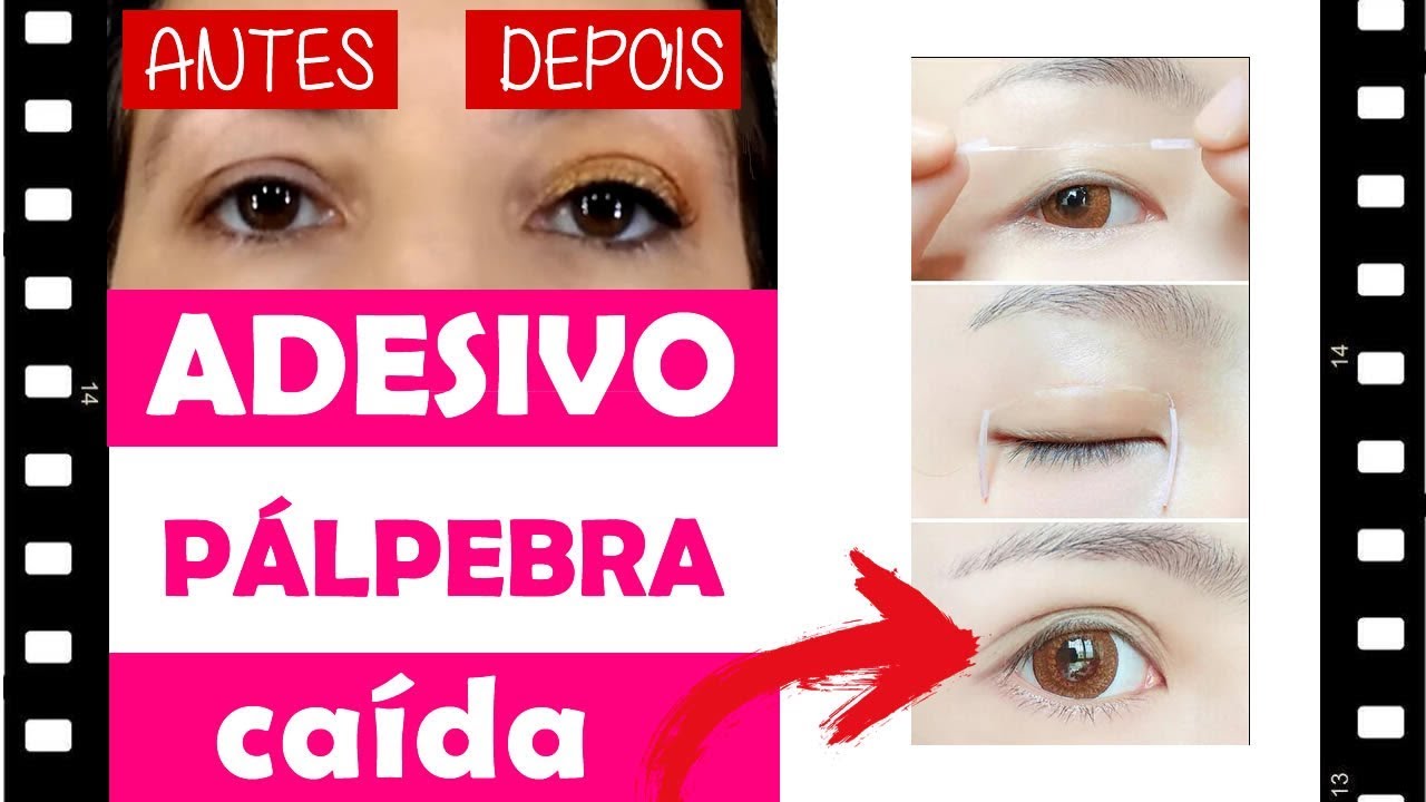 ADESIVO PÁLPEBRA CAÍDA - Como levantar as pálpebras caídas - YouTube