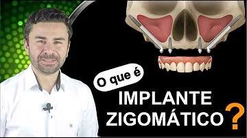O que é o processo zigomático?