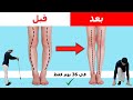 افضل 8 تمارين لعلاج تقوس الساقين للبالغين في شهر Bow Legs علاج تقوس الساقين للخارج 