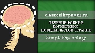 Лечение фобий в когнитивно-поведенческой терапии.