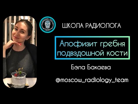 АПОФИЗИТ ГРЕБНЯ ПОДВЗДОШНОЙ КОСТИ/БЭЛА БАКАЕВА/MOSCOW RADIOLOGY TEAM